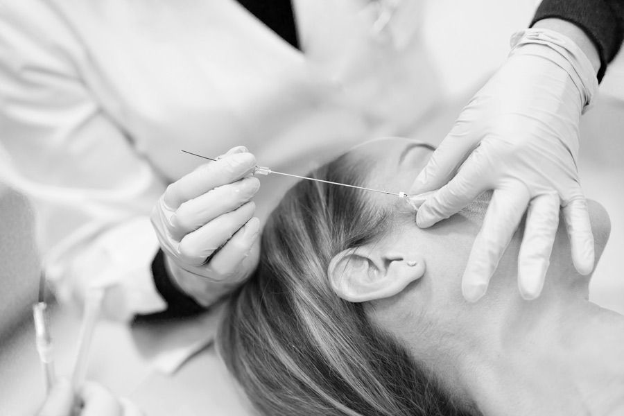 Fadenlifting Lifting Wange Dresden